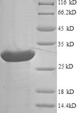 Agouti-related protein (AGRP), human, recombinant