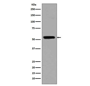Anti-Acetyl-p53 (Lys370), clone DEO-20