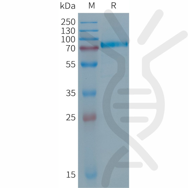 Human DSG2(50-609) Protein, His Tag