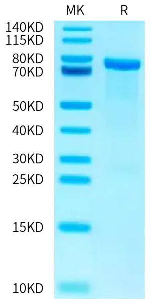 Human AKT2 Protein