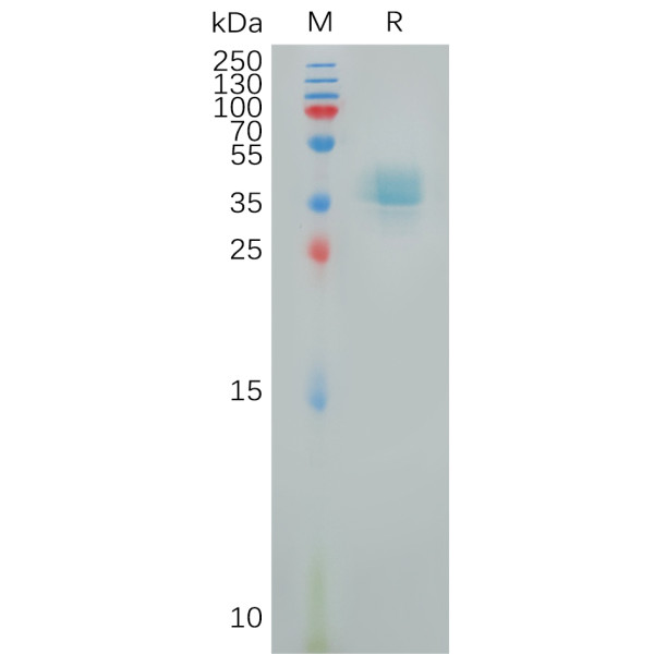 Human PTGER4 Protein, hFc Tag