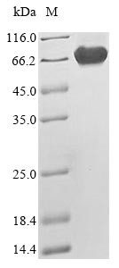 Merlin (NF2), human, recombinant