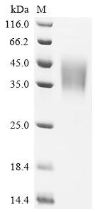 Low affinity immunoglobulin gamma Fc region receptor III-B (FCGR3B), partial, human, recombinant