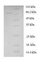 Cystathionine beta-lyase (STR3), Saccharomyces cerevisiae, recombinant