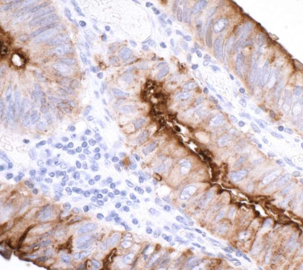 Anti-CEACAM1 Recombinant Monoclonal