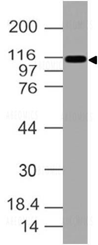 Anti-CD11C