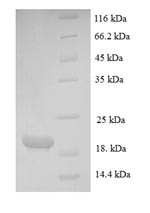 Parathyroid hormone-related protein (PTHLH), partial, human, recombinant