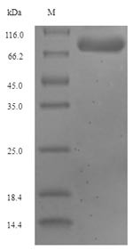 Glutaminase liver isoform, mitochondrial (GLS2), human, recombinant