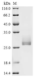 Interleukin-6 (IL6), Biotinylated, human, recombinant