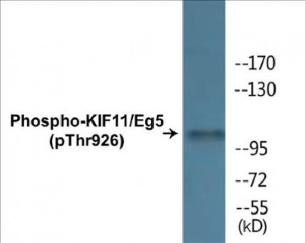 KIF11/Eg5 (Phospho-Thr926) Colorimetric Cell-Based ELISA Kit