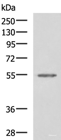 Anti-SLC16A1