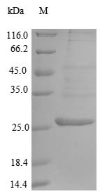 Endoplasmic reticulum aminopeptidase 1 (Erap1), partial, mouse, recombinant