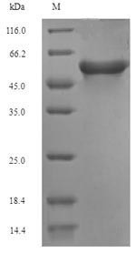 Acetyl-CoA carboxylase 1 (Acaca), partial, rat, recombinant