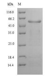 Alanine aminotransferase 1 (GPT), human, recombinant