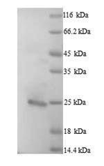 Bcl-2-like protein 11 (BCL2L11), human, recombinant