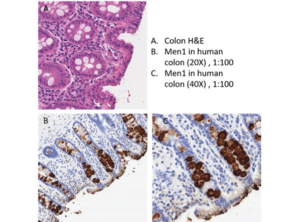 Anti-MEN1 Antibody