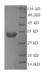 B-lymphocyte antigen CD20 (Ms4a1), partial, mouse, recombinant