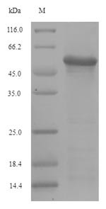 Hemagglutinin (HA), partial, Influenza A virus, recombinant