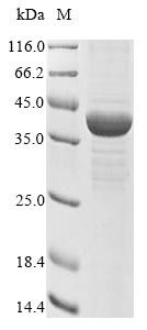 Acetyl-CoA acetyltransferase, mitochondrial (ACAT1), human, recombinant