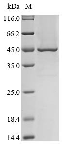 Transmembrane protease serine 11A (TMPRSS11A), partial, human, recombinant