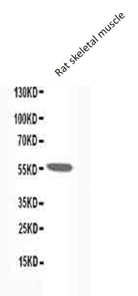 Anti-CHRNA1 / Nicotinic Acetylcholine R alpha 1