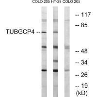 Anti-TUBGCP4