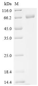 CD276 antigen (CD276), partial, Biotinylated, human, recombinant