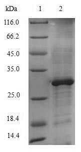 Lanosterol 14-alpha demethylase (ERG11), partial, Saccharomyces cerevisiae, recombinant