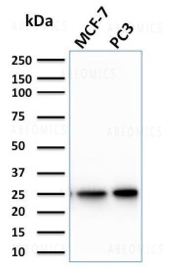 Anti-Calcineurin B homologous protein 2 / HCC Antigen 520 Monoclonal Antibody (Clone: CPTC-CHP2-1)