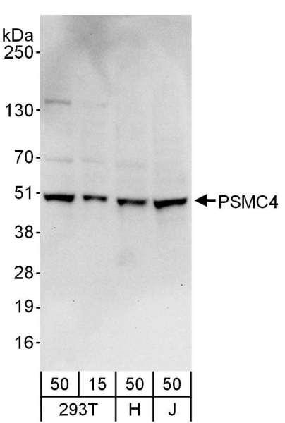 Anti-PSMC4