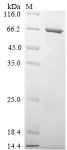 Fc receptor-like protein 3 (FCRL3), partial, human, recombinant