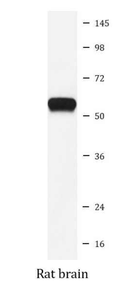 Anti-CYP19A1 / Aromatase