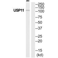 Anti-USP11