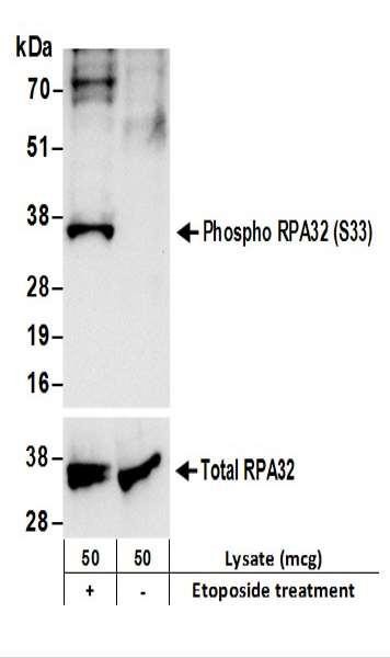 Anti-phospho-RPA32 (Ser33)
