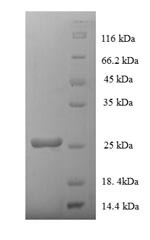 Major prion protein (Prnp), rat, recombinant