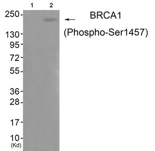 Anti-Phospho-BRCA1 (Ser1457)