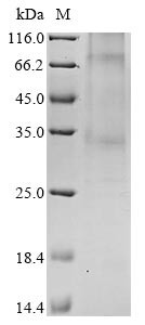 Leukocyte antigen CD37 (CD37), bovine, recombinant