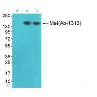 Anti-MET (Ab-1313)