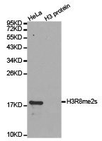 Anti-Histone H3R8me2s