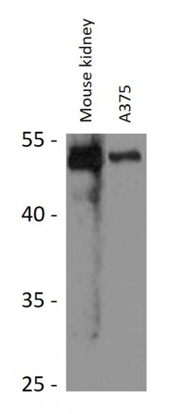 Anti-SERPINF1 / PEDF