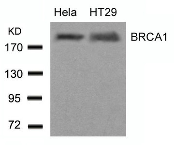 Anti-BRCA1 (Ab-1423)