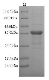 T-cell surface glycoprotein CD1c (CD1C), partial, human, recombinant