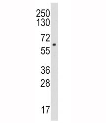 Anti-Aromatase