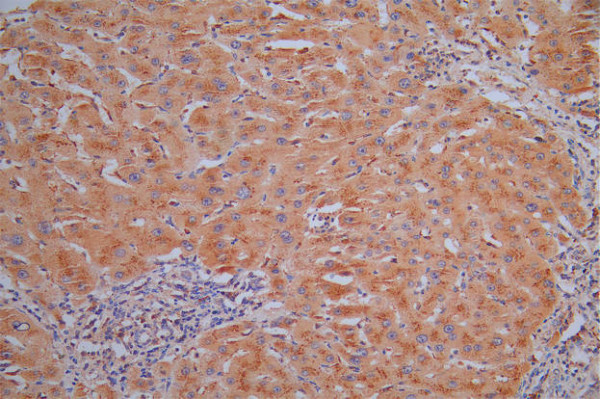 Anti-CTSL Recombinant Monoclonal, clone 12H6