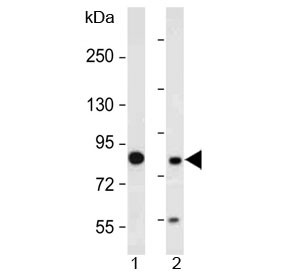 Anti-MUT / Methylmalonyl-CoA mutase (N-Terminal Region)