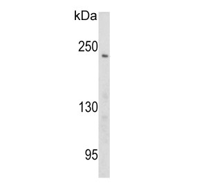 Anti-PCM1 / Pericentriolar material 1 protein