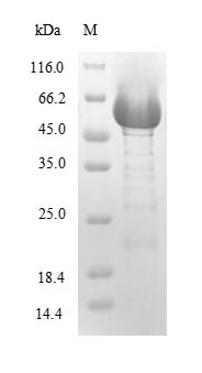 Hemolytic phospholipase C (plcH), partial, Pseudomonas aeruginosa, recombinant