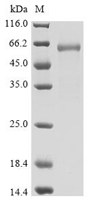 Spike glycoprotein (S), partial, Biotinylated (Active), Severe acute respiratory syndrome coronaviru