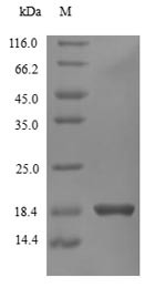 Interferon gamma (IFNG), human, recombinant