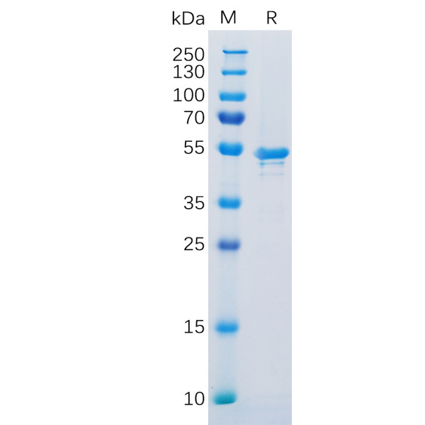 Human CA9 Protein, His Tag